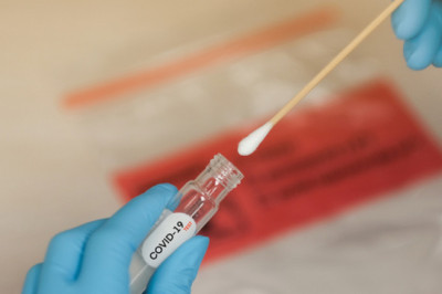 Coronavirus : Les tests de dépistage PCR seront désormais payants