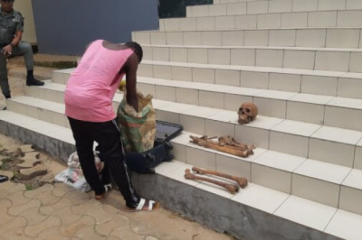 Cameroun : Quatre trafiquants de squelettes mis aux arrêts à Yaoundé.