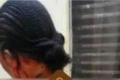 Bangangté : Une femme enceinte brûlée par sa coépouse